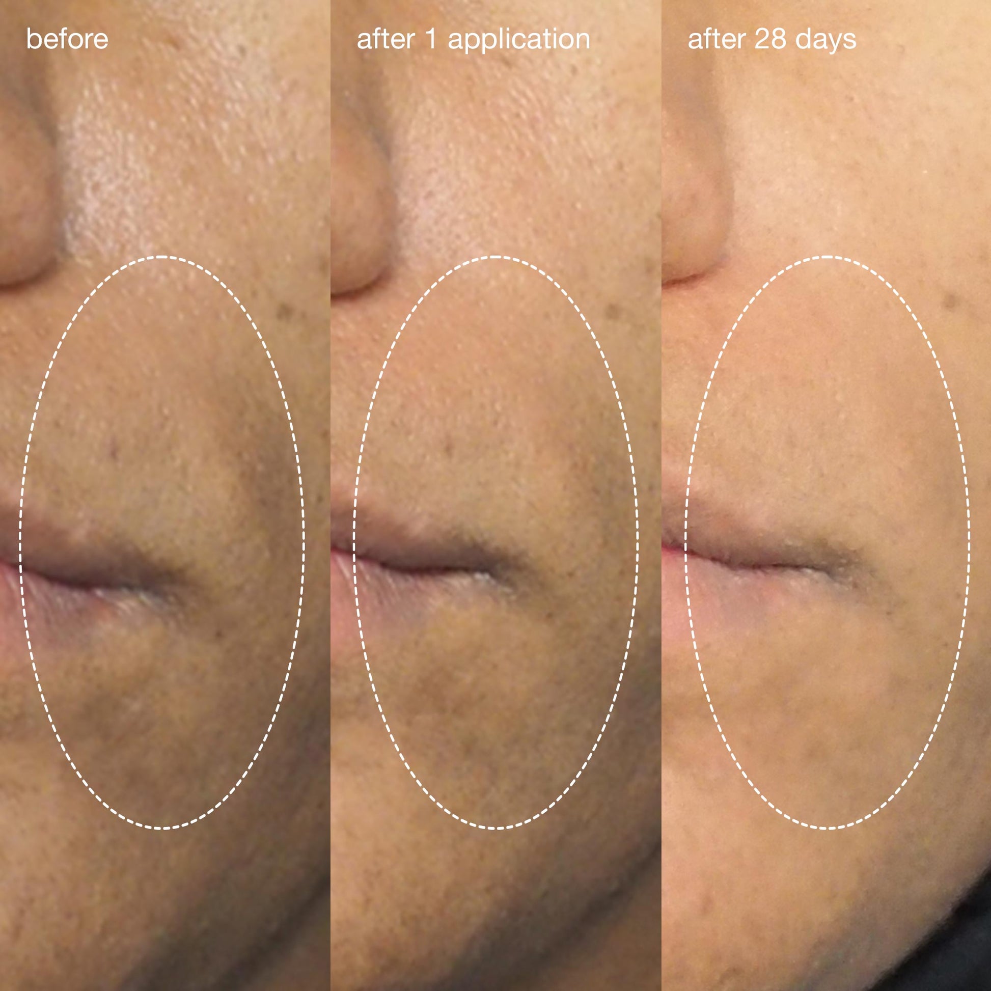 liquid peelfoliant before and after