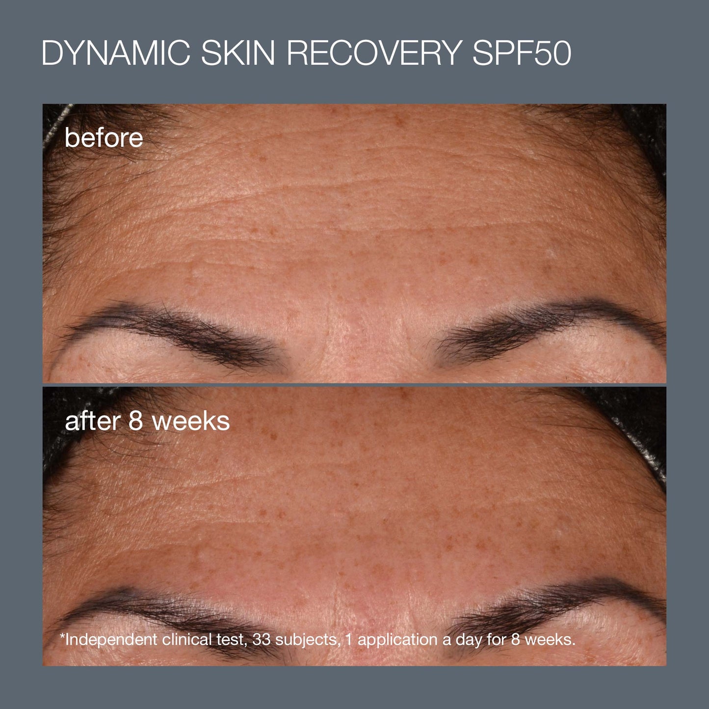 before and afters of dynamic skin recovery spf 50 after 8 weeks