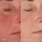 stabilizing repair cream before and after