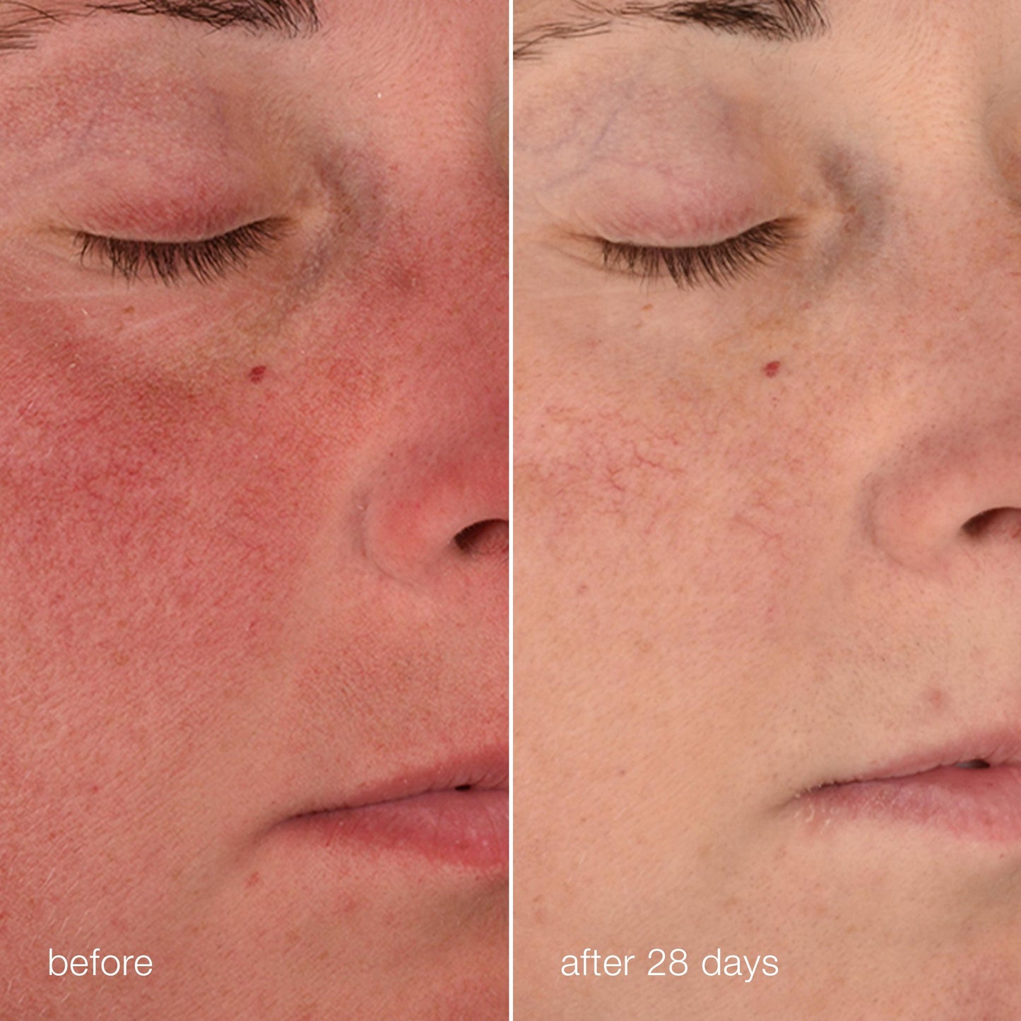 stabilizing repair cream before and after 