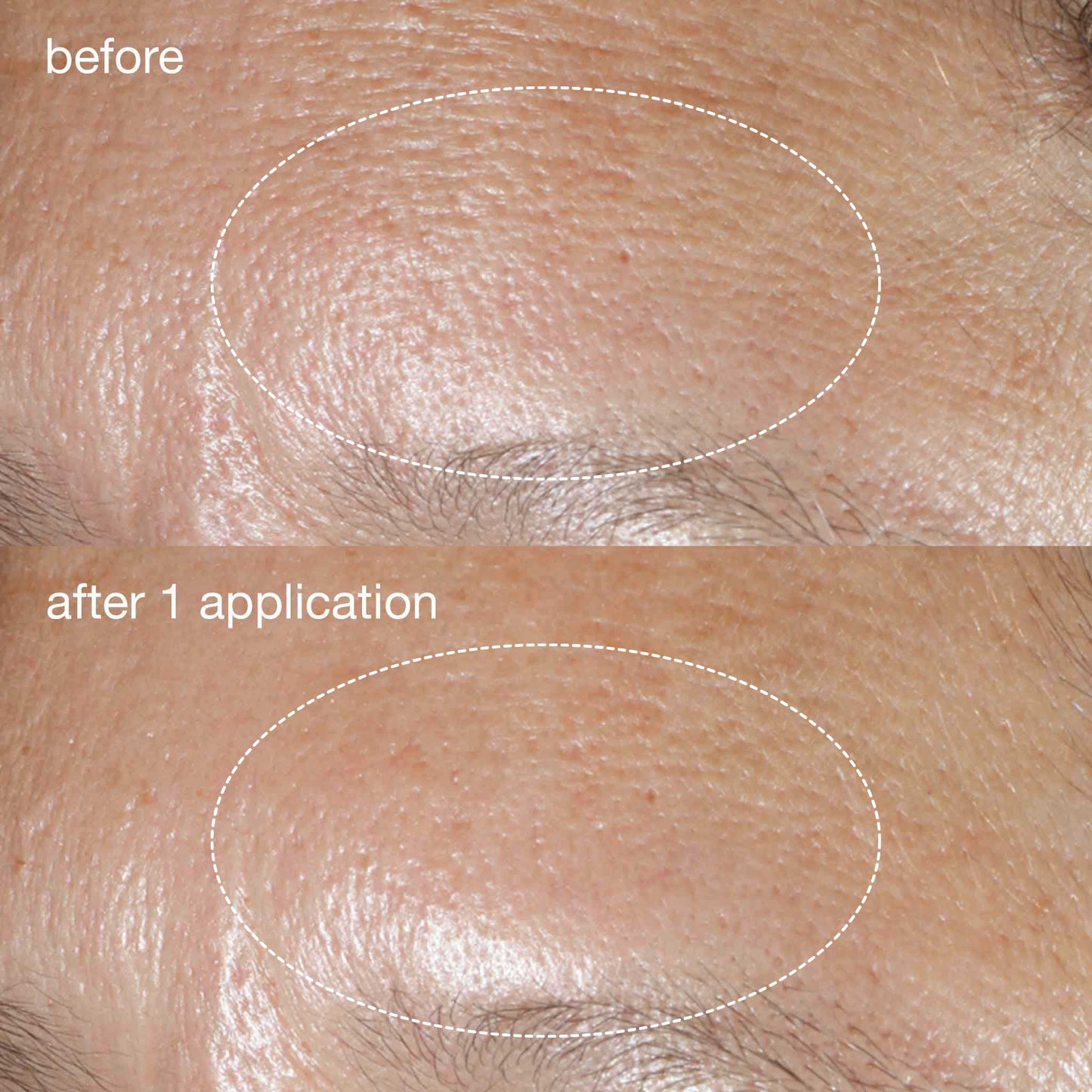 phyto nature oxygen cream before and after  1 application
