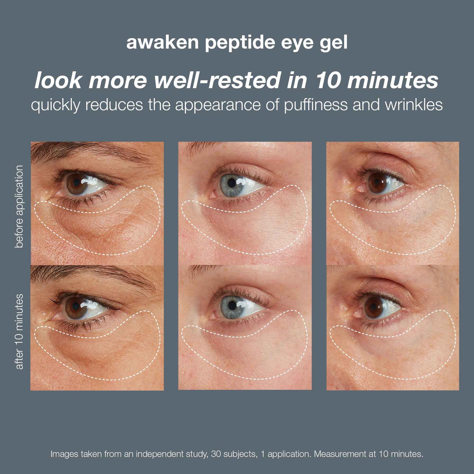 awaken peptide eye gel before and after