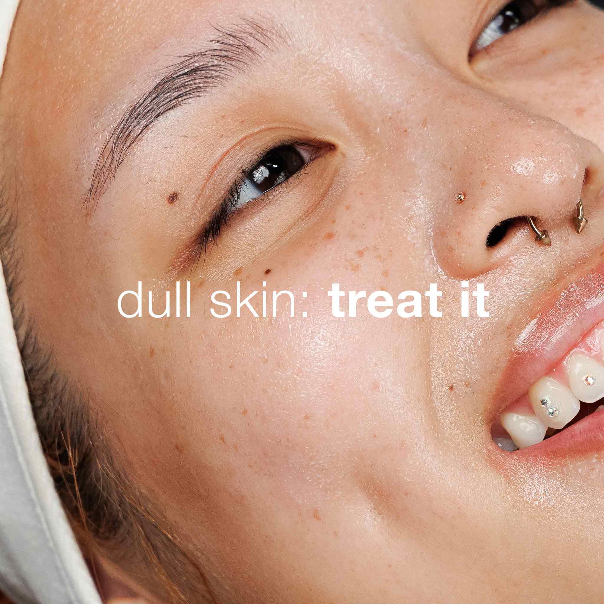 dull skin: treat it