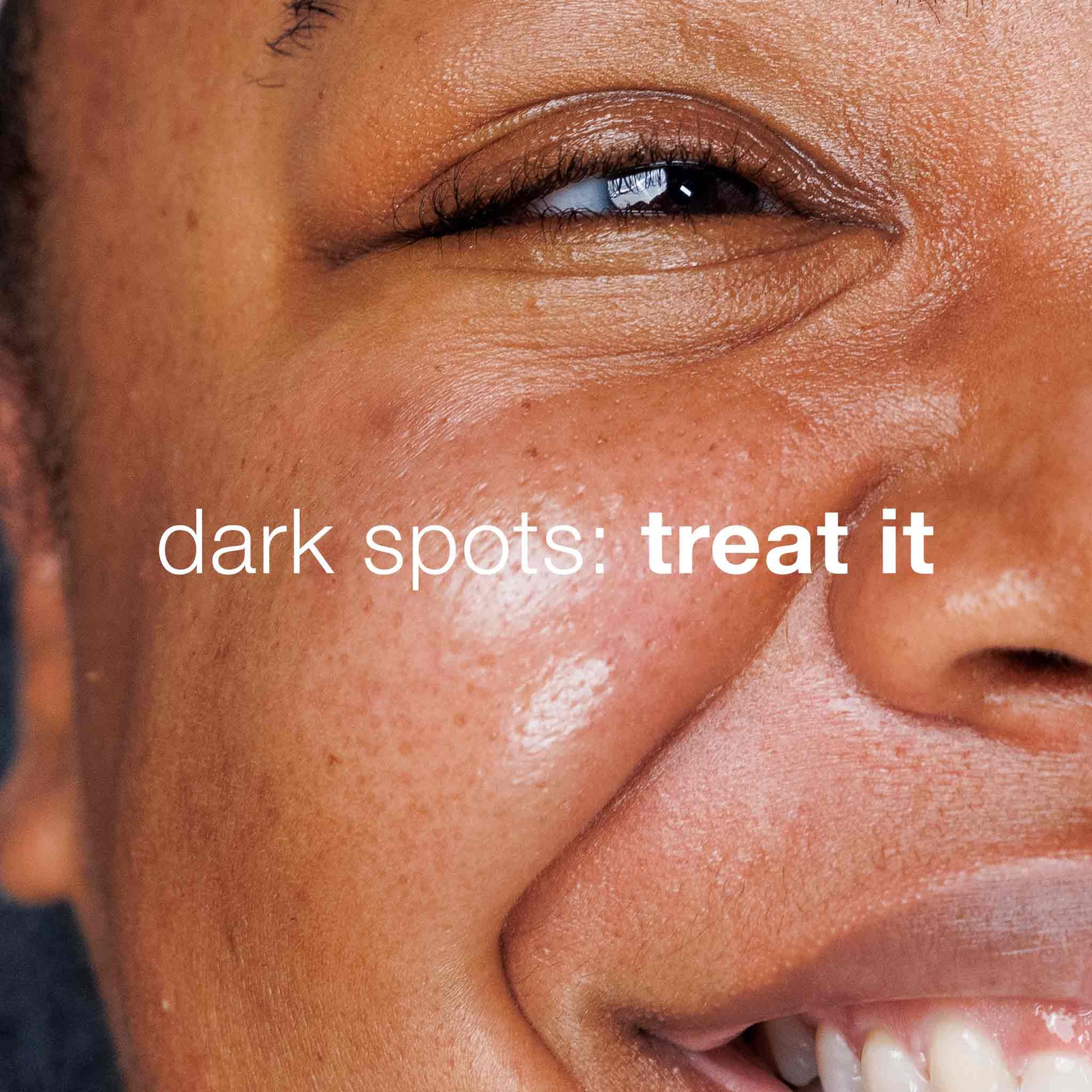 dark spots: treat it