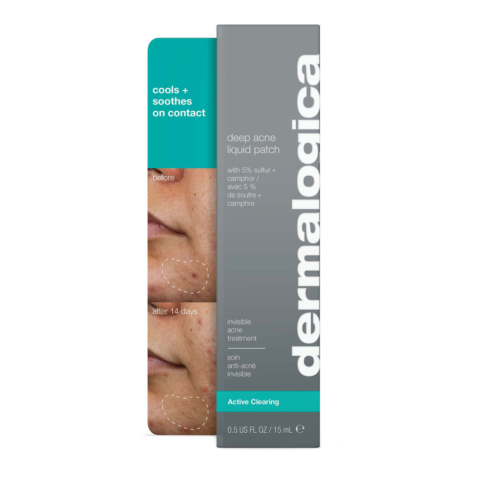 Deep Acne Liquid Patch, Invisible Sulfur Treatment with Niacinamide ...