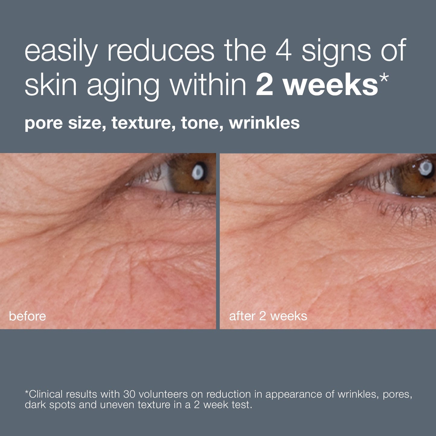 dynamic skin retinol serum before and after